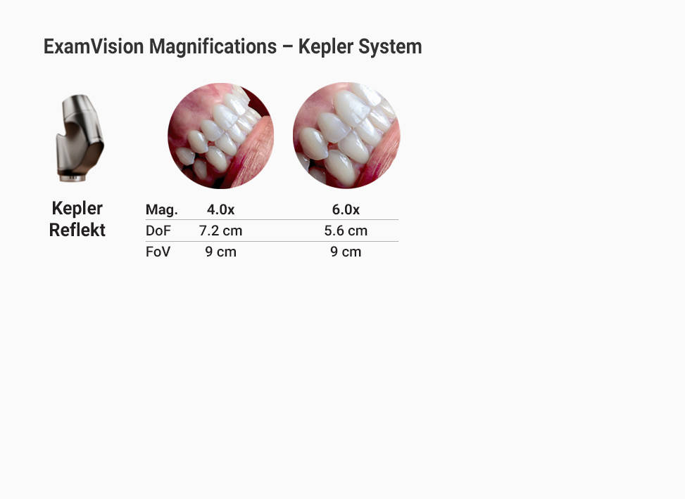 Przegląd Kepler Reflekt