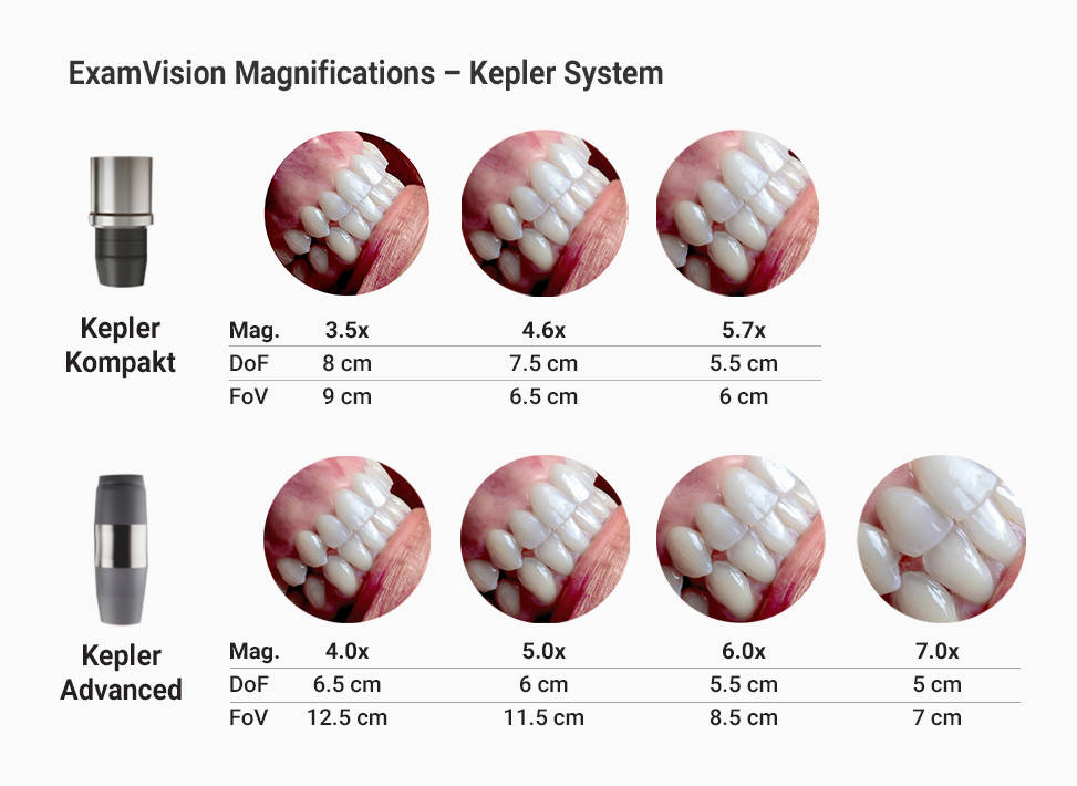 Przegląd Kepler Advanced i Kepler Kompakt